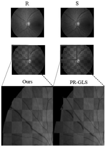 Multi-mode retinal fundus image registration method and device