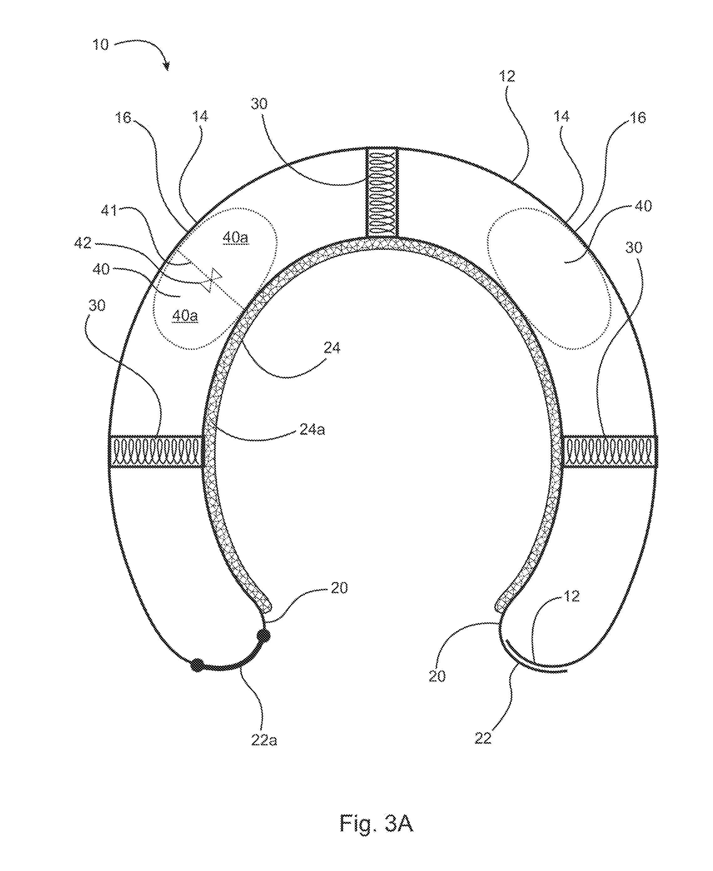 Helmet with multiple protective zones