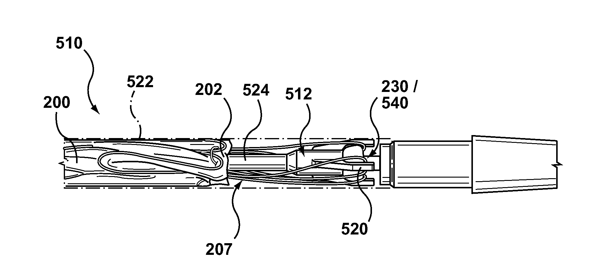 Ring on a closed web stent-graft for use in tip capture