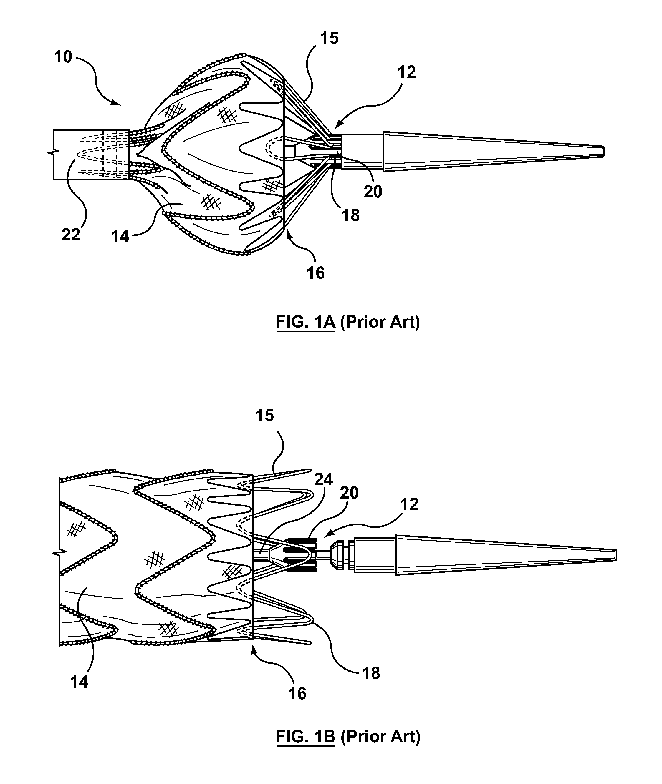 Ring on a closed web stent-graft for use in tip capture