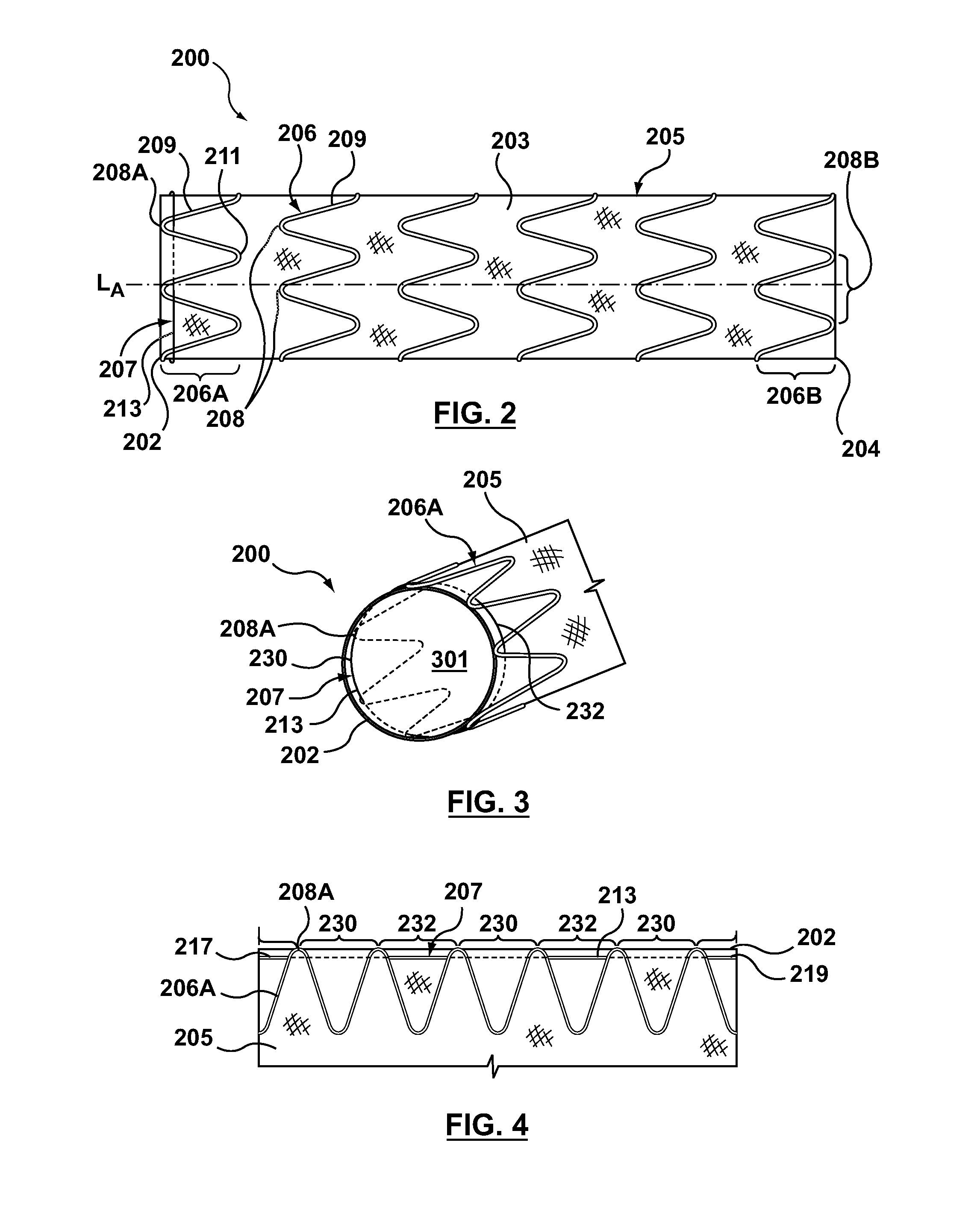 Ring on a closed web stent-graft for use in tip capture