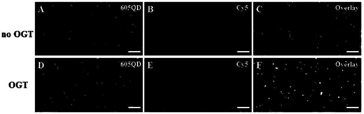 Nano-sensor for detecting O-acetylglucosamine transferase and detection method of nano-sensor