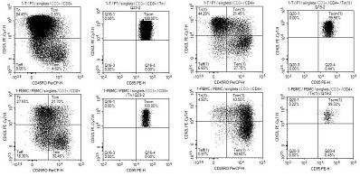 Clinical TSCM (T-memory stem cells) induction culture and quality control identification kit and application