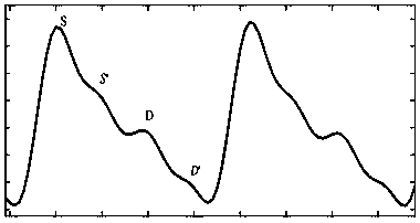 Blood pressure calculation method and blood pressure measuring device