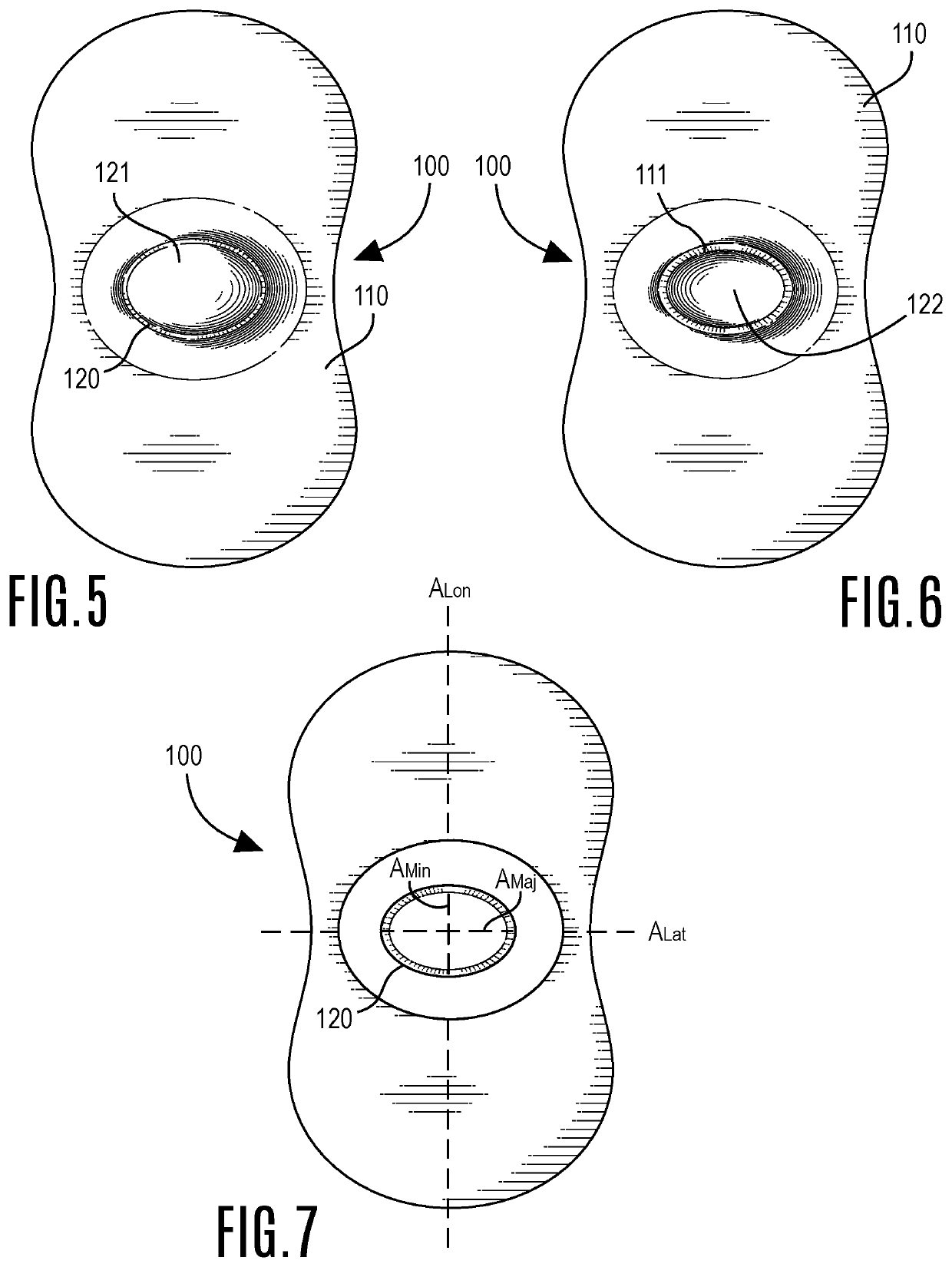 Finger-splinting sheath device & method