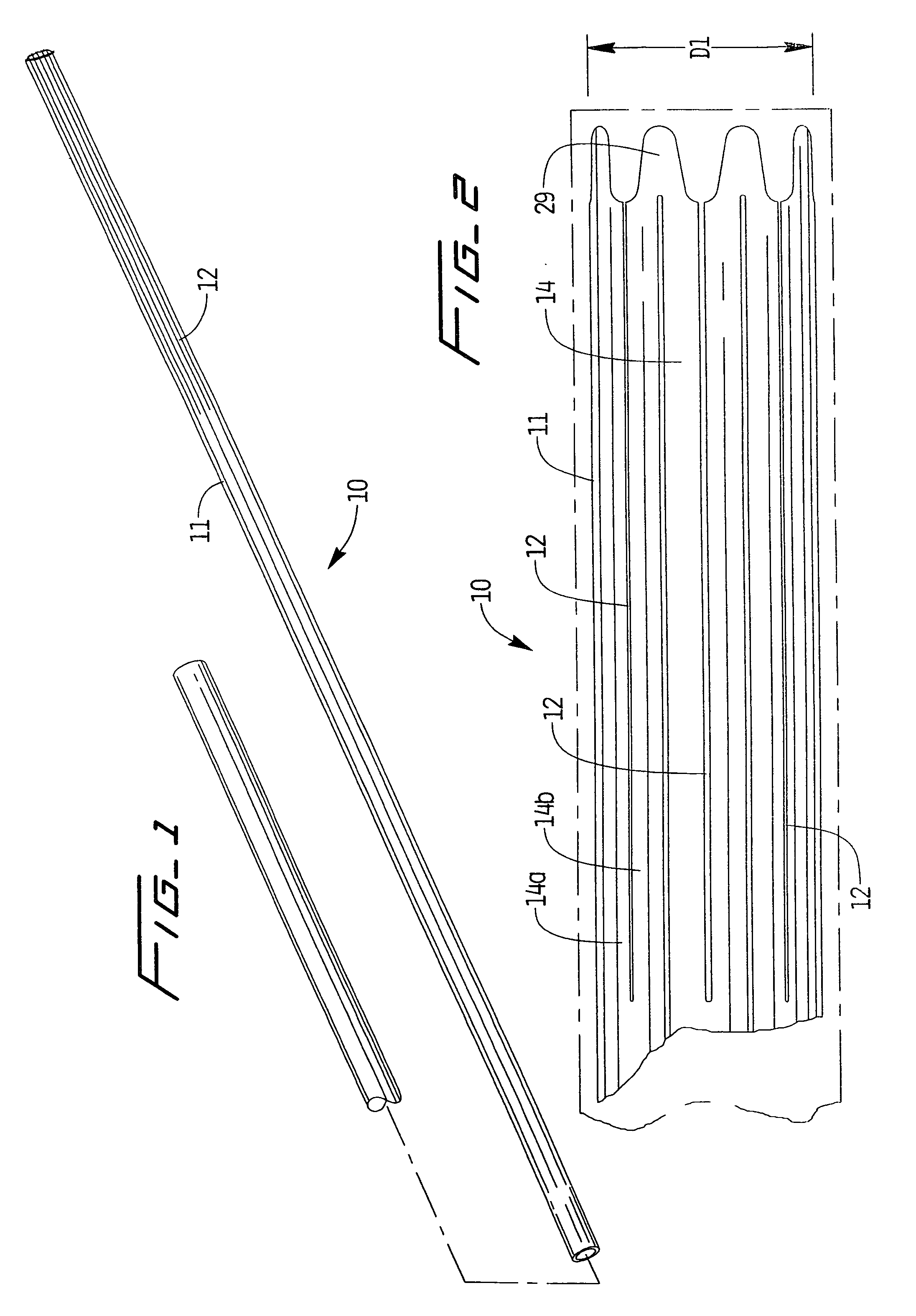 Vein filter