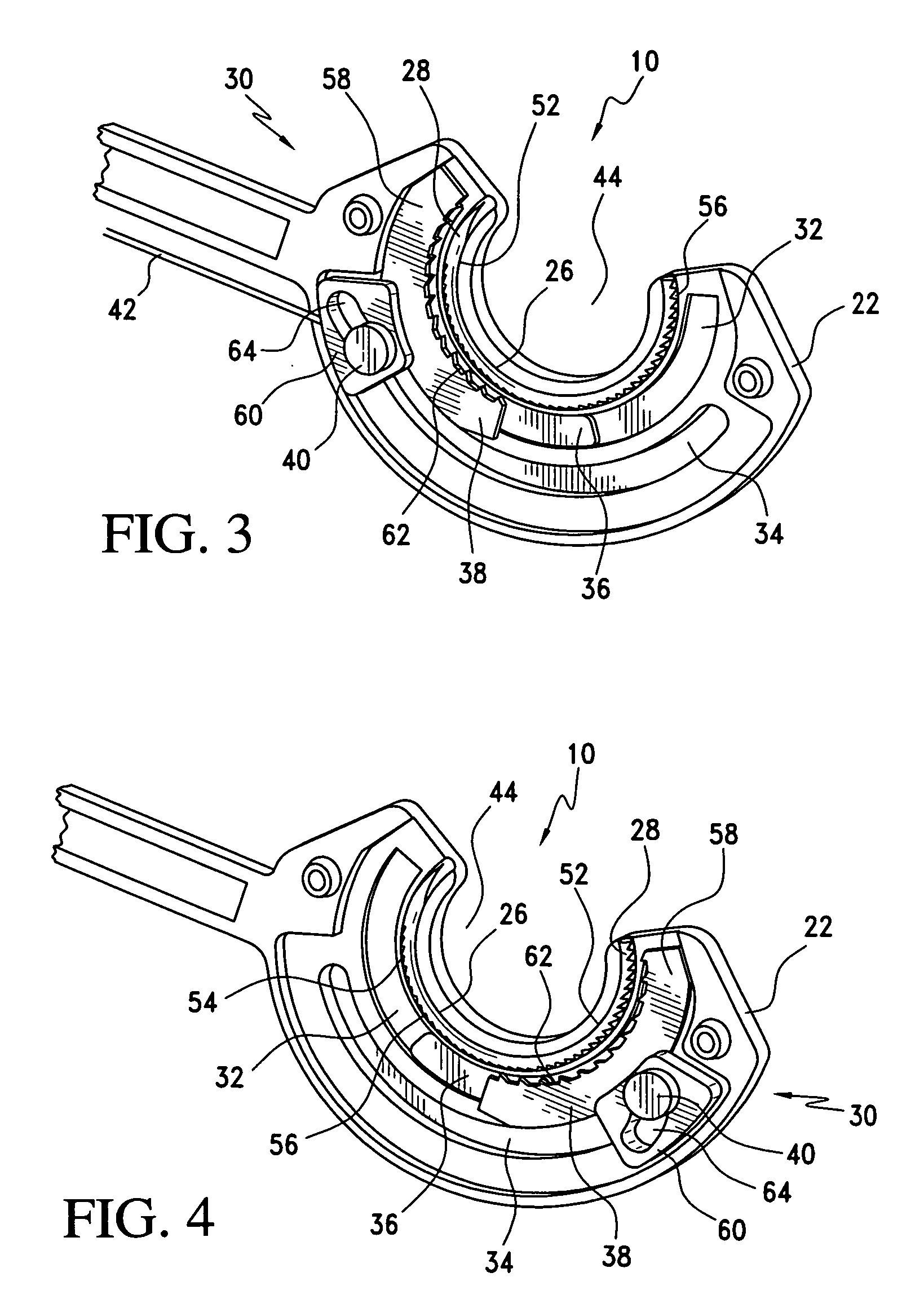 Surgical suturing apparatus with anti-backup system