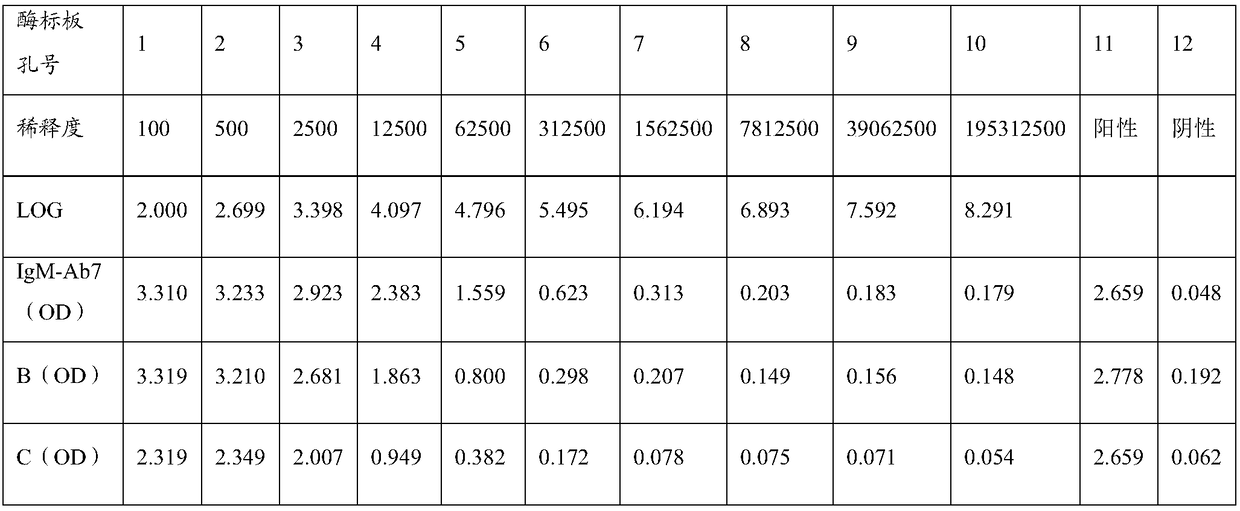 Anti-human IgM monoclonal antibody, hybridoma cell strain and application thereof