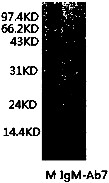 Anti-human IgM monoclonal antibody, hybridoma cell strain and application thereof