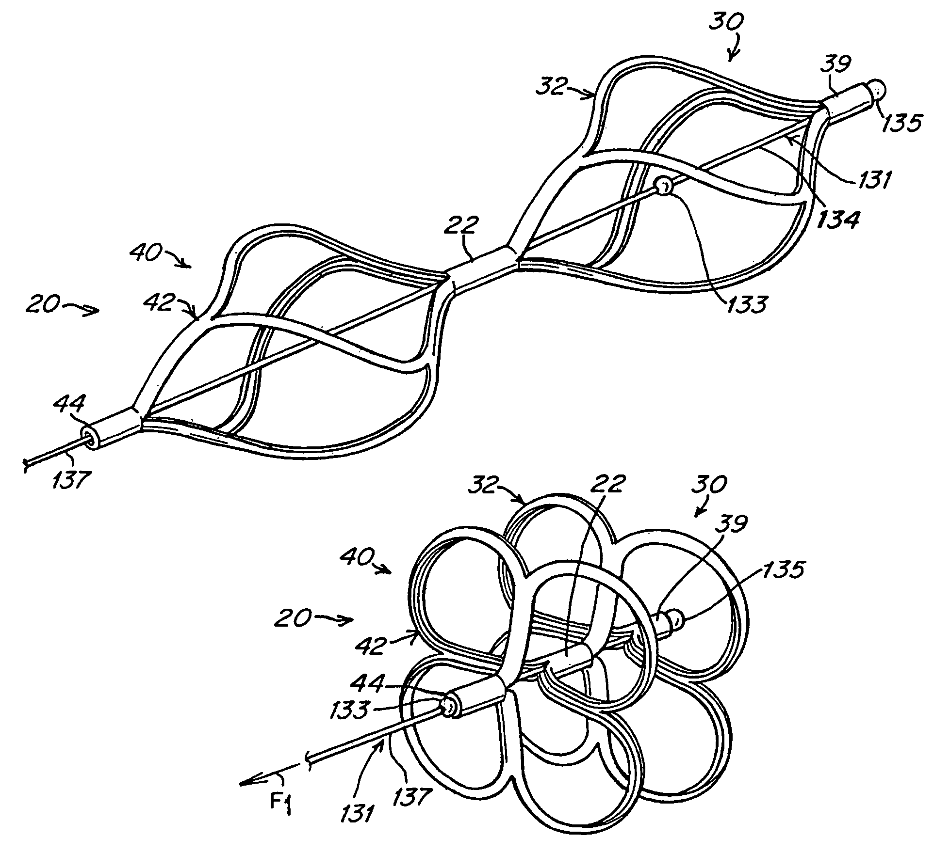 Tubular patent foramen ovale (PFO) closure device with catch system