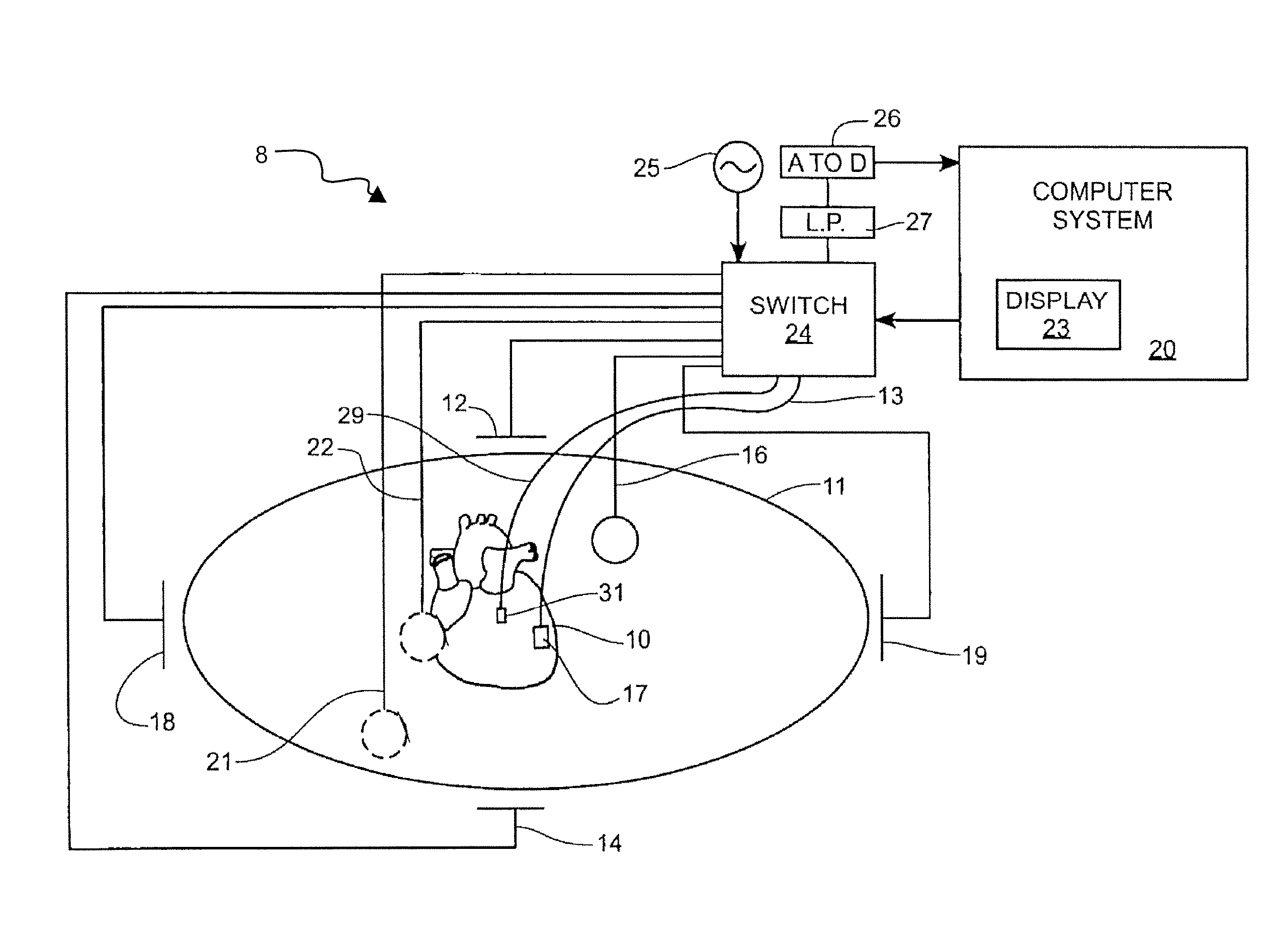 System and method for three-dimensional mapping of electrophysiology information