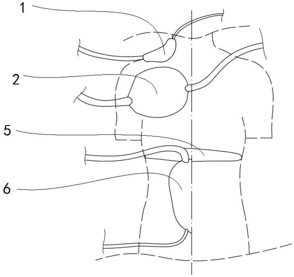 Trunk tumor radiotherapy simulation mold