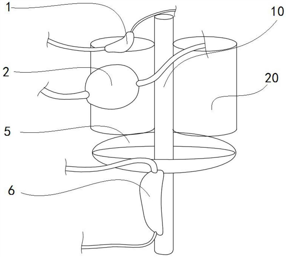 Trunk tumor radiotherapy simulation mold