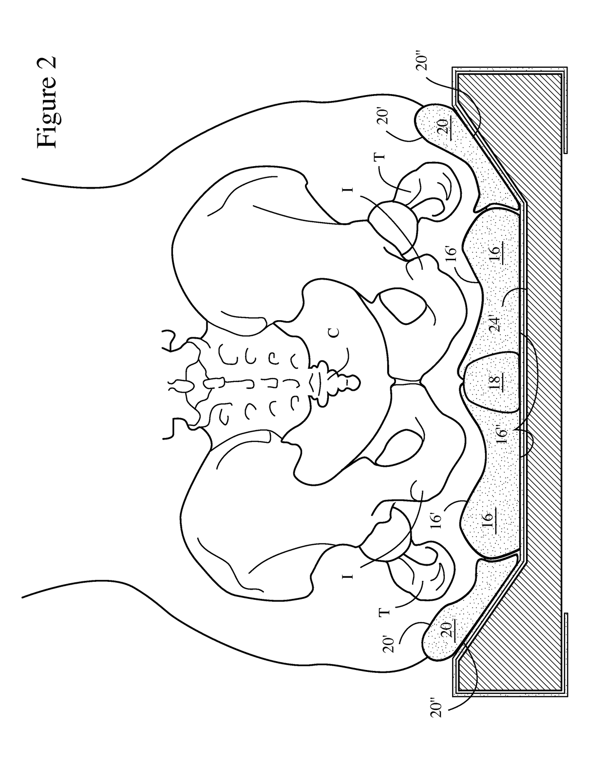 Wheelchair cushion with adjustable/multi-stiffness fluid