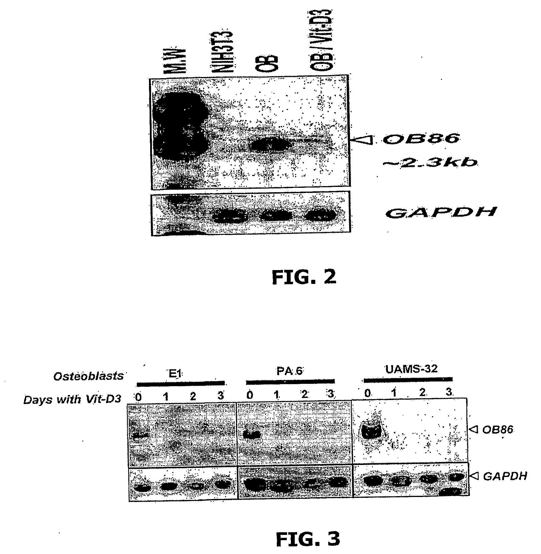 Compositions and Methods for Regulating Osteoclast Differentiation, Activation and Bone Resorption