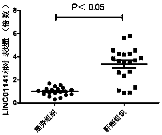 Long-chain non-coding RNA gene marker for detecting liver cancer and application of long-chain non-coding RNA gene marker for detecting liver cancer