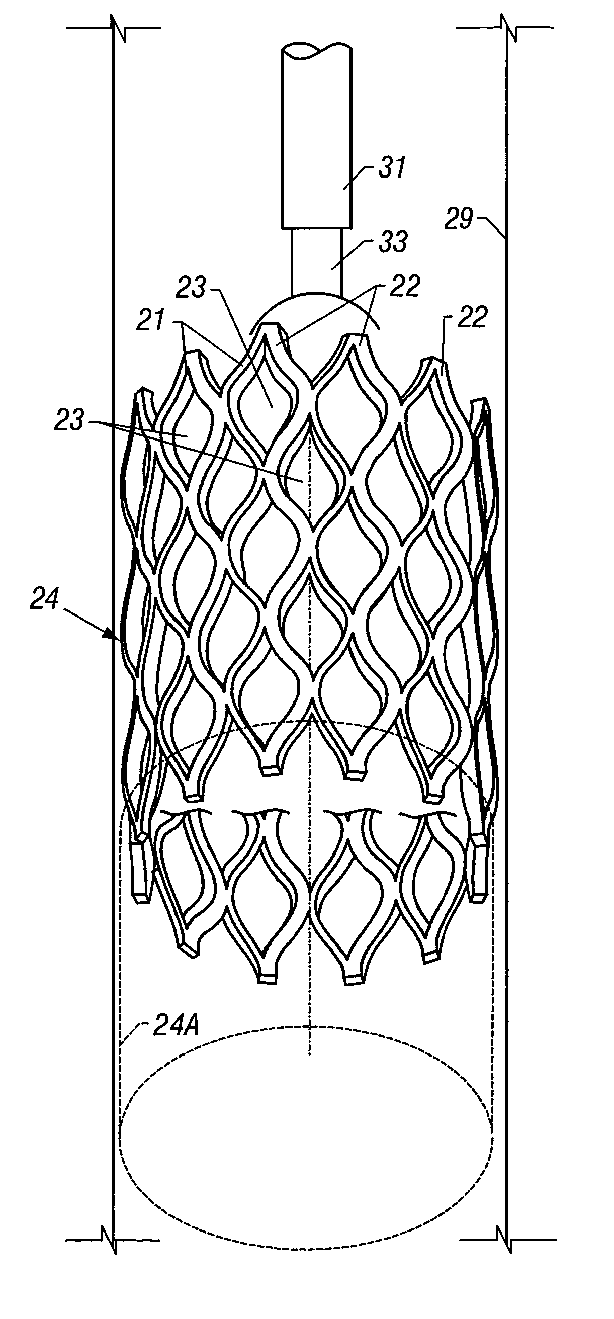 Apparatus comprising expandable bistable tubulars and methods for their use in wellbores