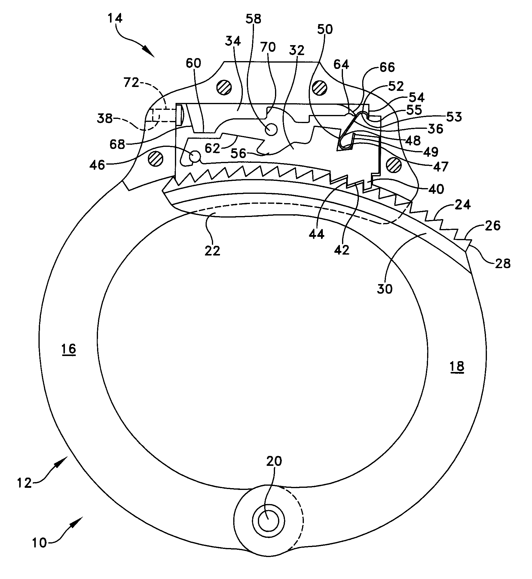 Locking mechanism for restraints with improved resilience