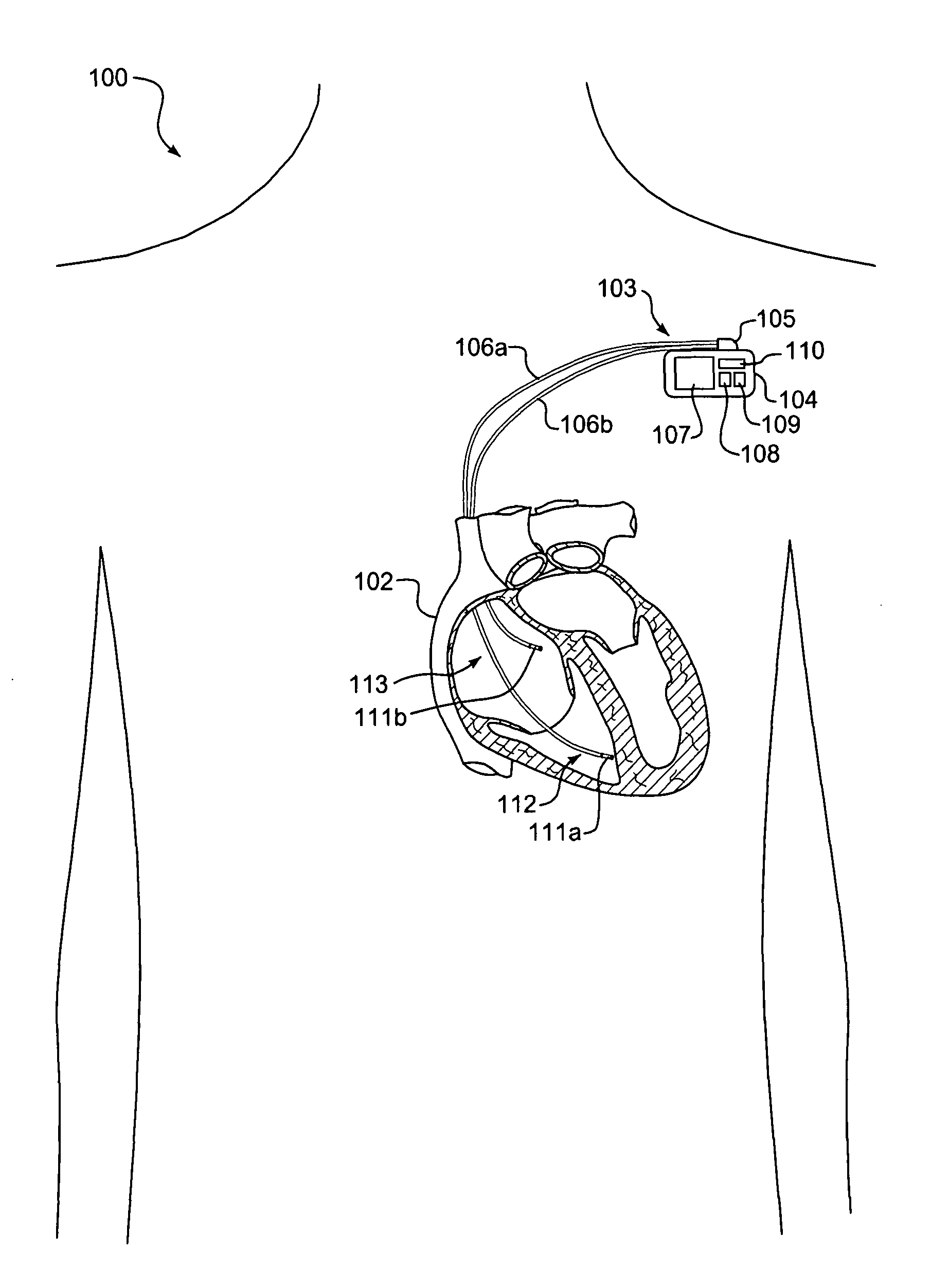 External data processing device to interface with an ambulatory repeater and method thereof