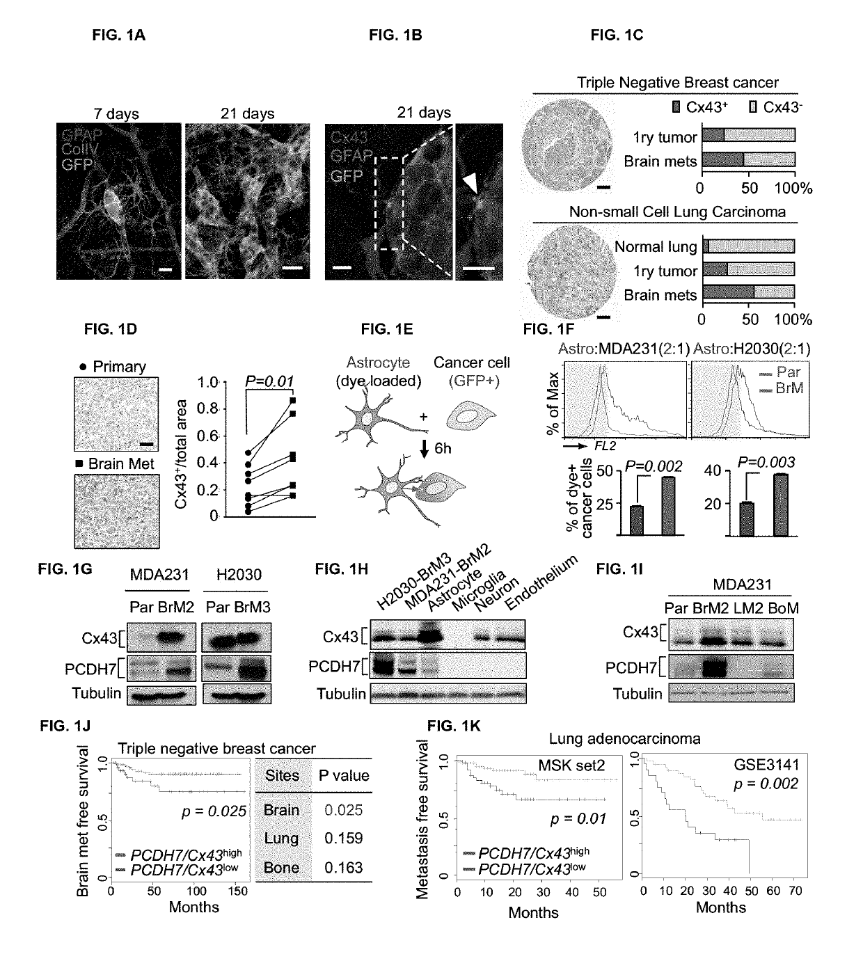 Methods for treating brain metastasis