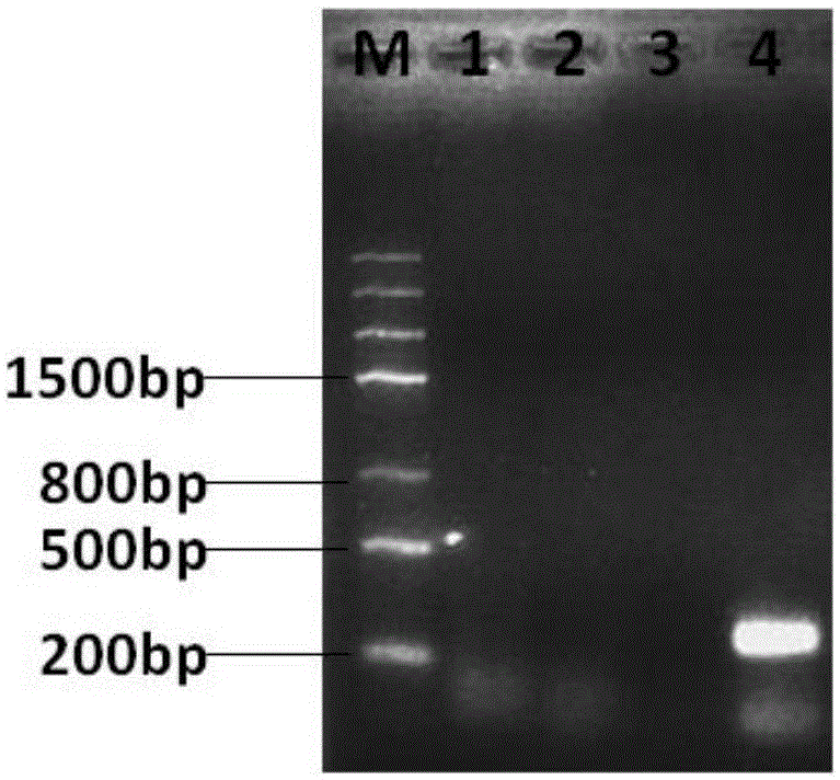 Normal-temperature and constant-temperature nucleic acid amplification method using fluorescence probe