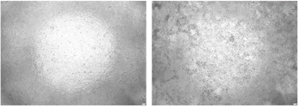 Detection method of interferon biological activity