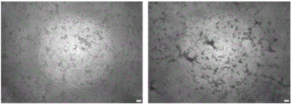 Detection method of interferon biological activity