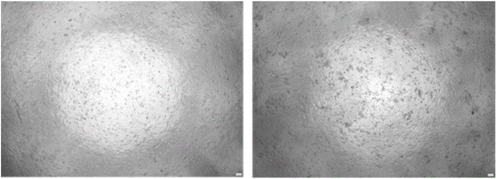 Detection method of interferon biological activity