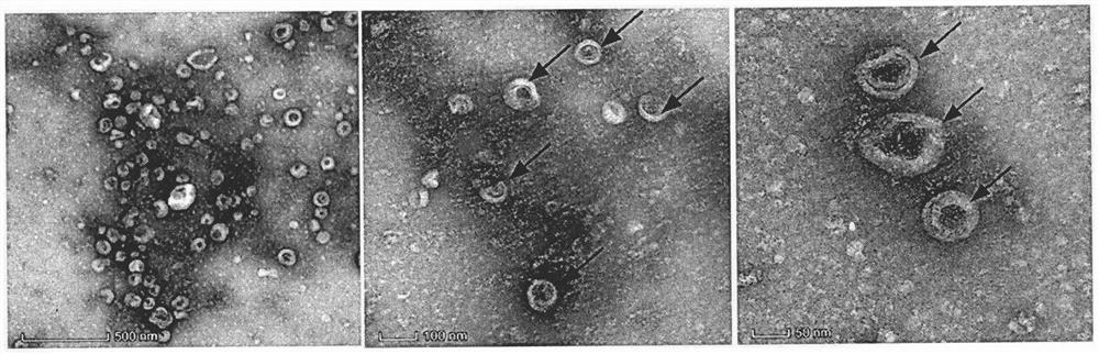 A method and application of blocking vertical transmission of chicken avian leukemia virus