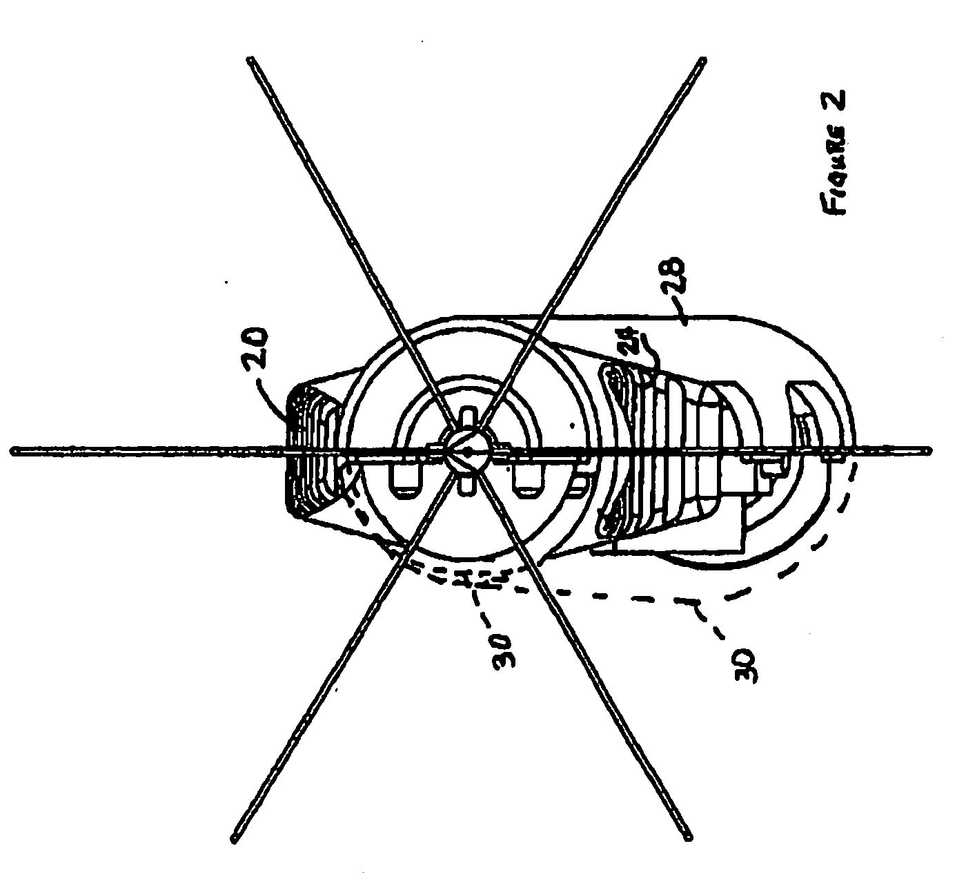 Anchored RF ablation device for the destruction of tissue masses