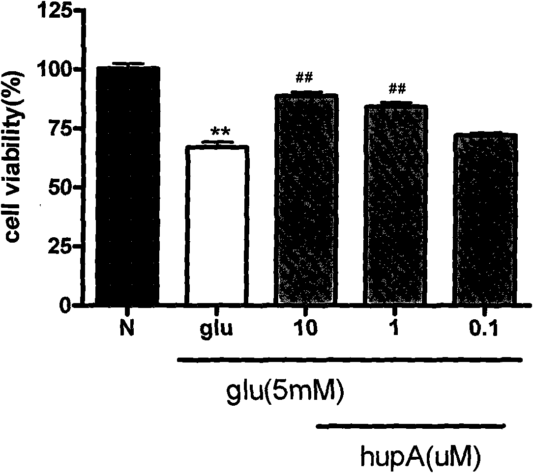 Application of Huperzine A in preparing medicaments