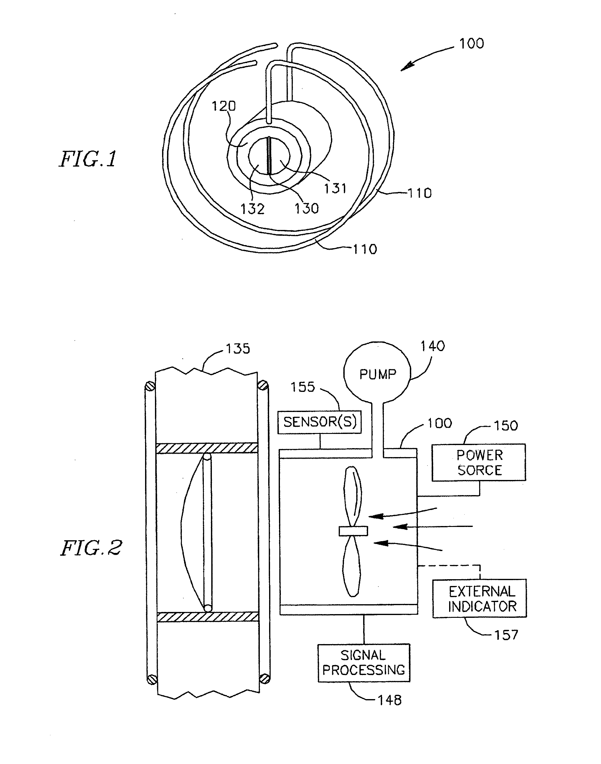 Methods and apparatus for reducing localized circulatory system pressure