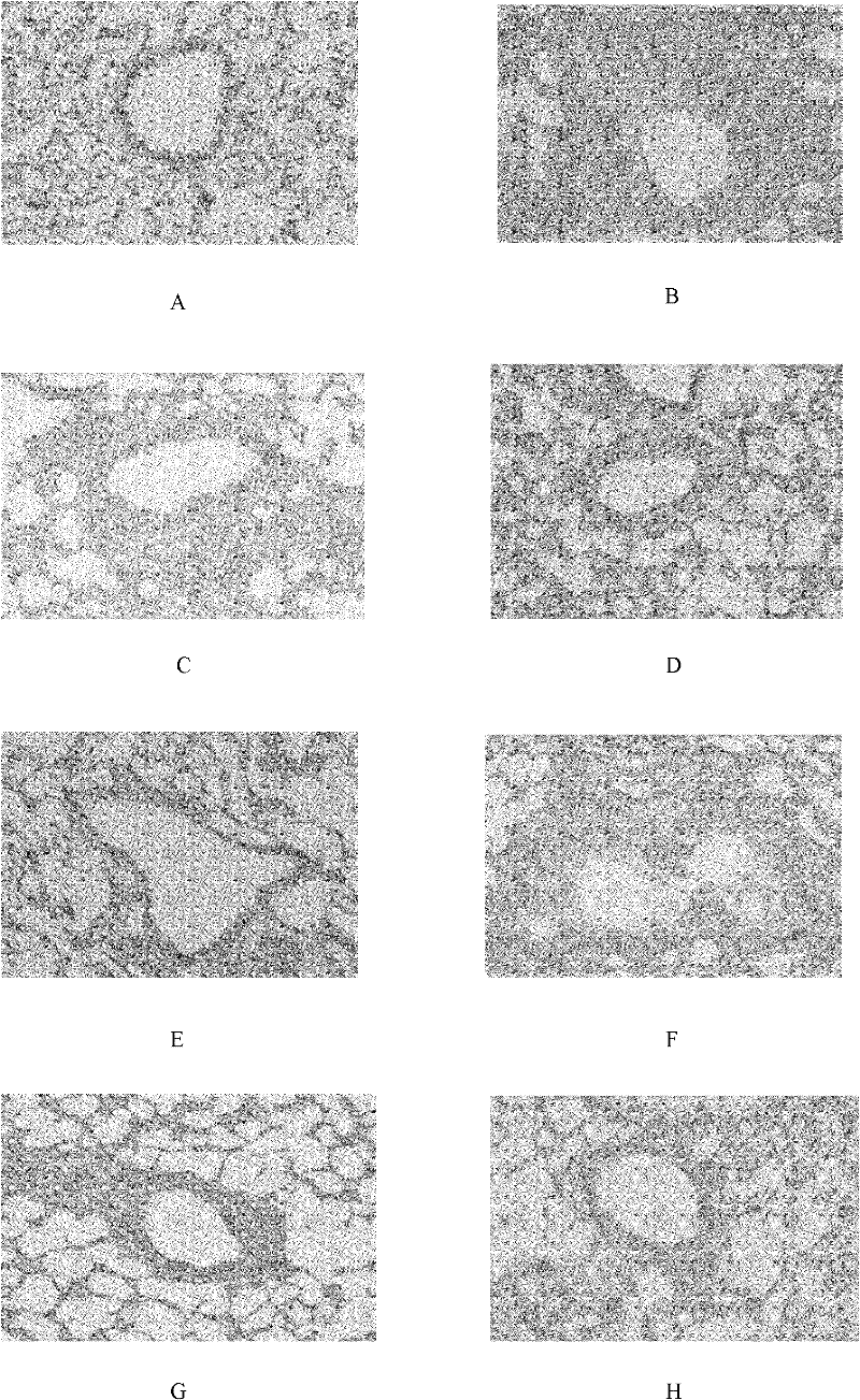 Medicinal composition for preventing and treating bronchial asthma and preparation and application thereof