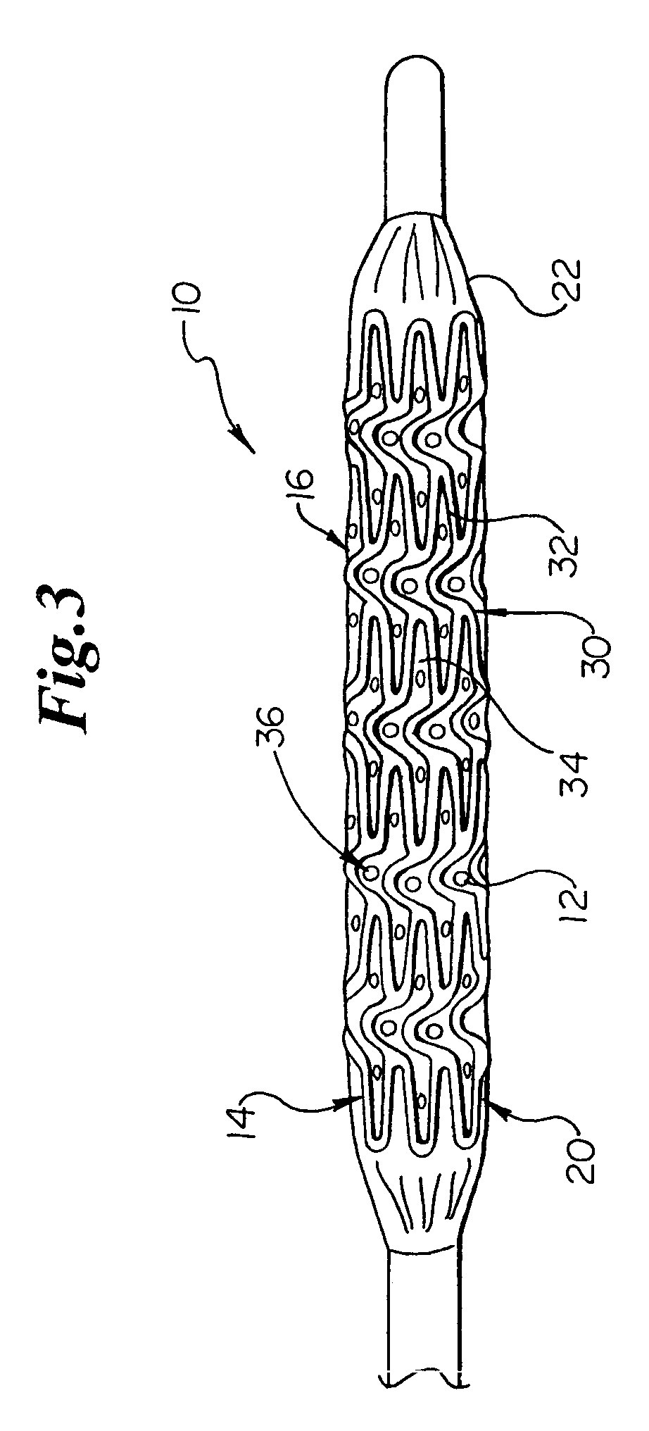 Catheter balloon with improved retention