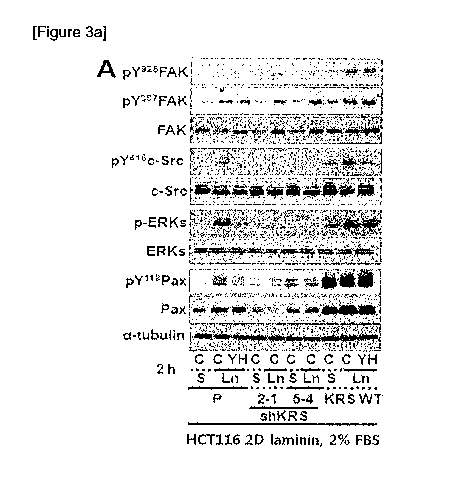 Method for screeing cancer metastasis inhibitor using culture of cells or spheroidically aggregated cells in which lysyl-trna synthetase is regulated to be expressed or unexpressed