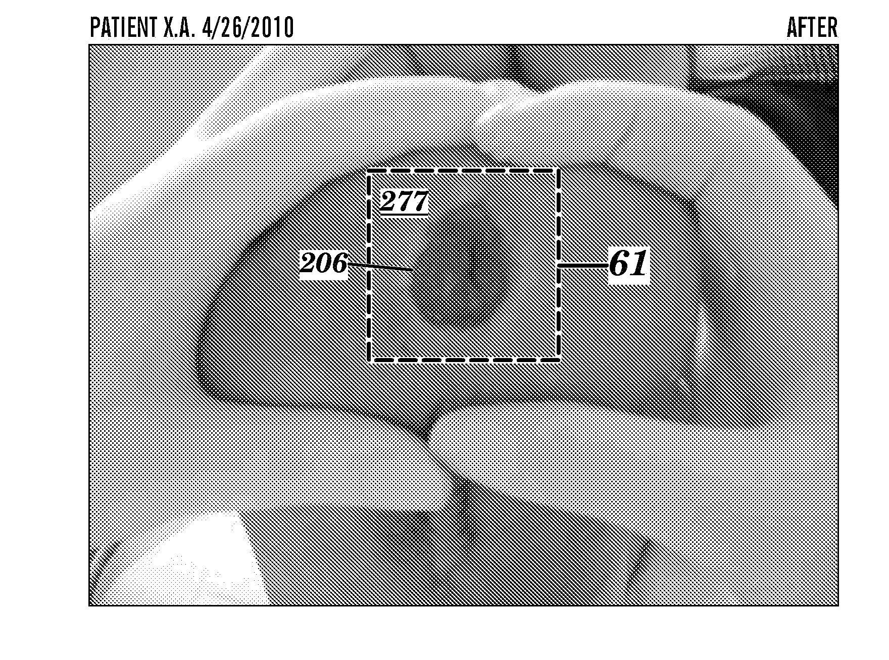 Topical drug delivery system with dual carriers