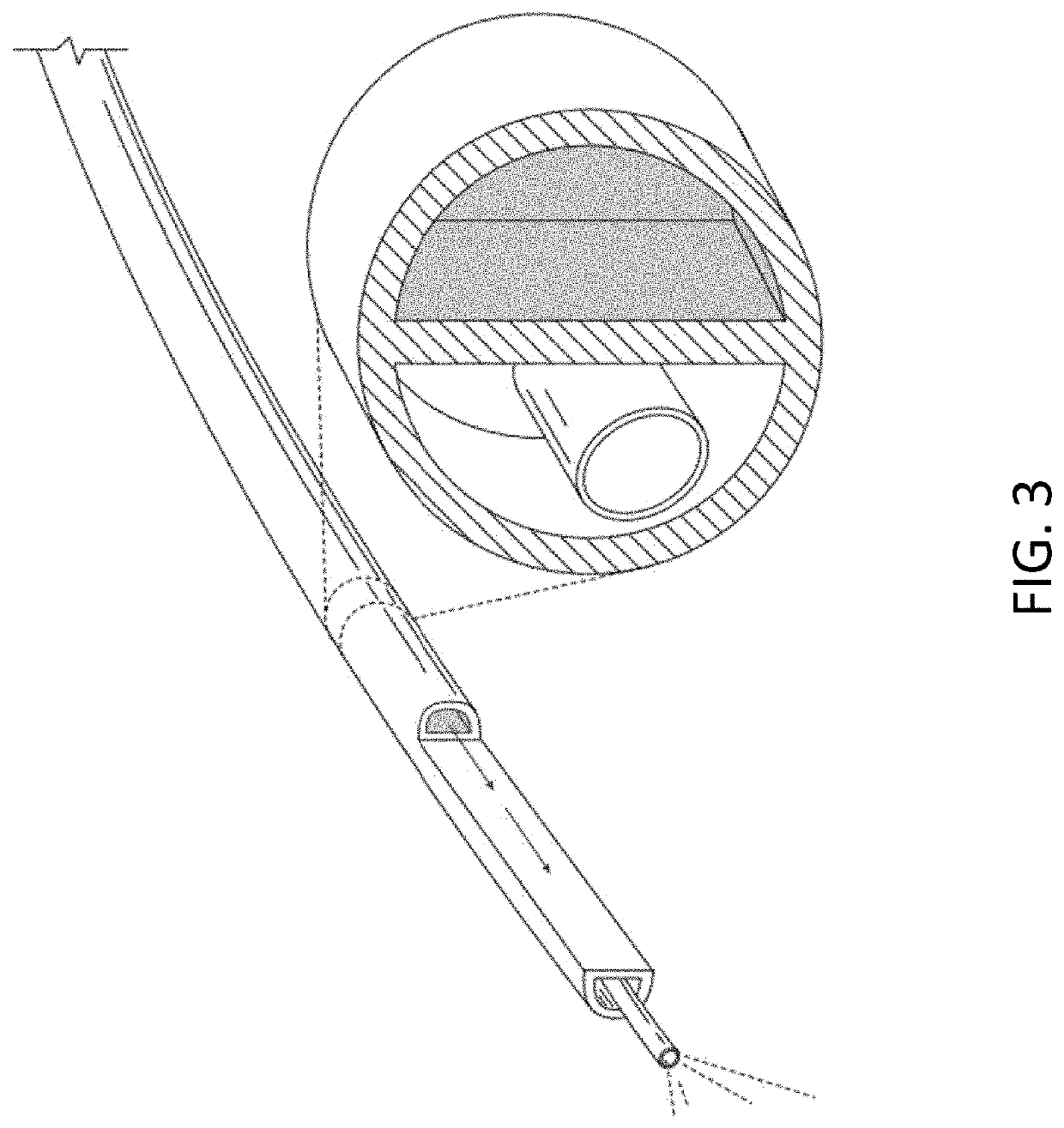 Methods and apparatus for delivering a stimulus to an occlusive implant