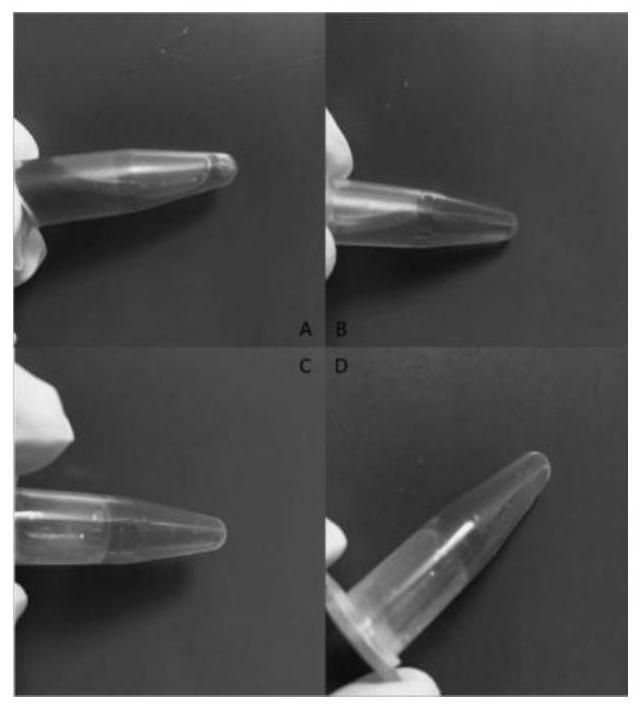 Method for extracting matrix gel from cattle and donkey skin