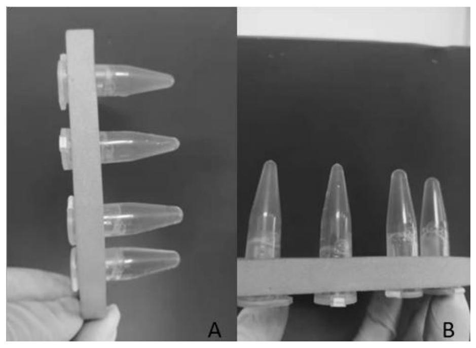 Method for extracting matrix gel from cattle and donkey skin