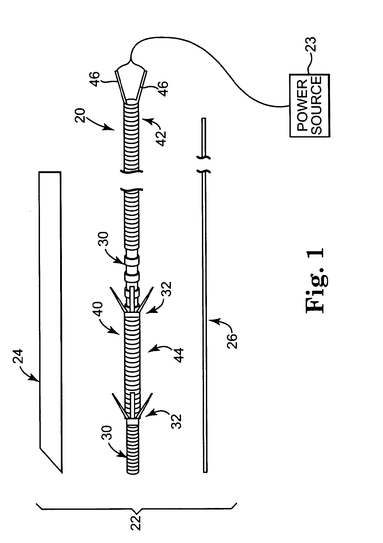 Implantable medical electrical stimulation lead, such as pne lead, and method of use