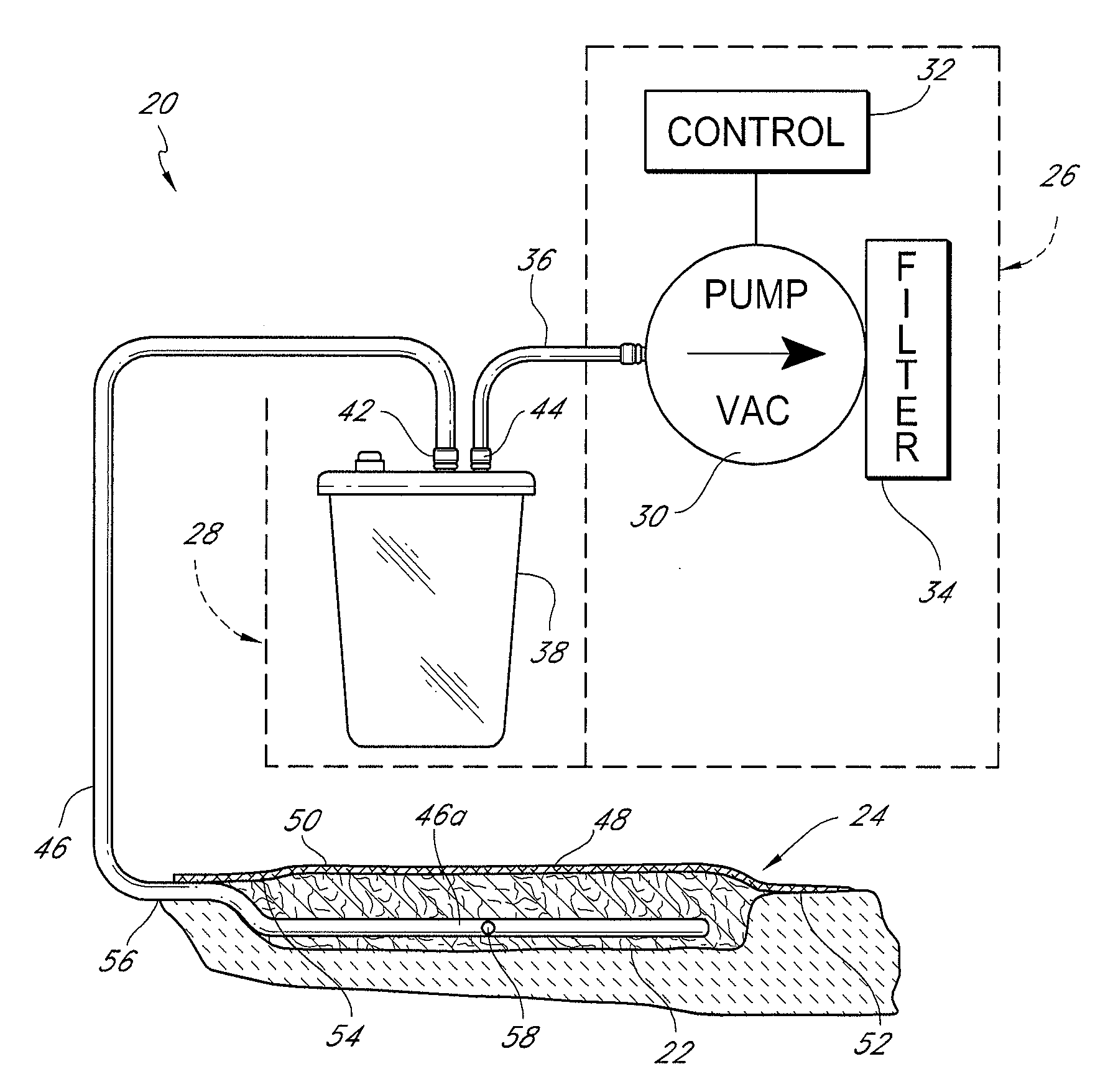 Auxiliary powered negative pressure wound therapy apparatuses and methods