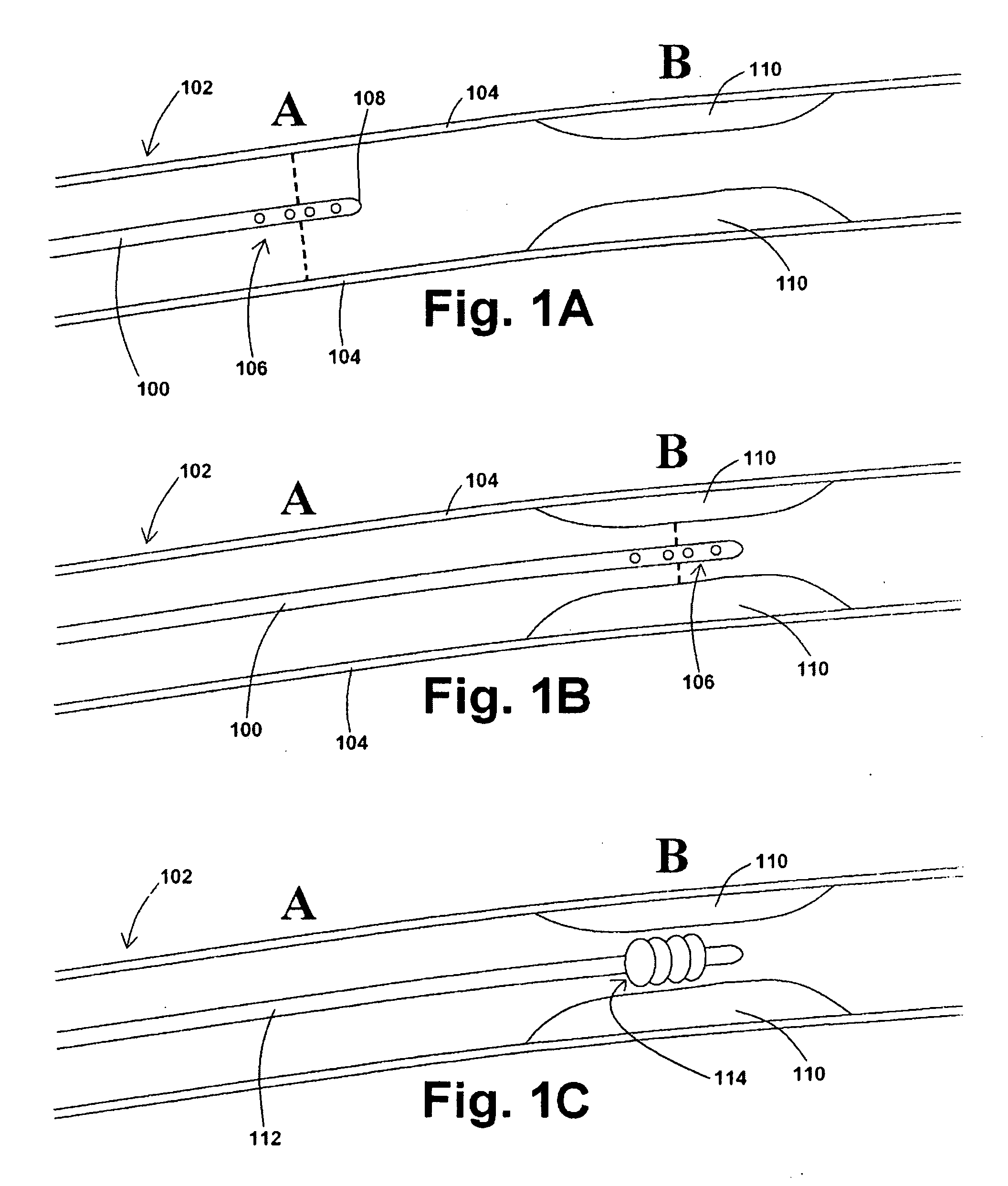 Devices, systems, and methods for removing stenotic lesions from vessels