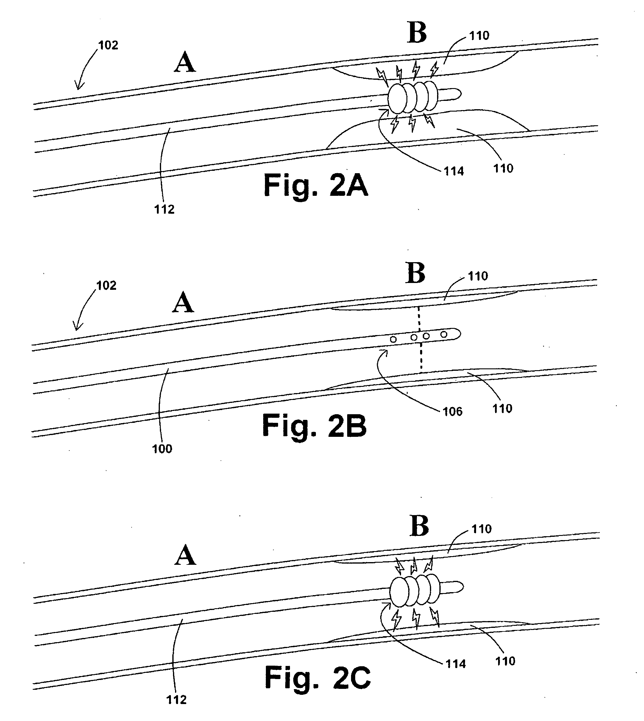 Devices, systems, and methods for removing stenotic lesions from vessels