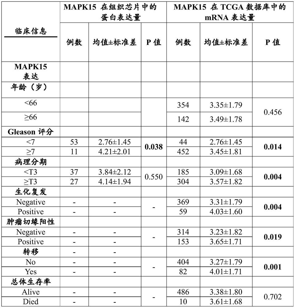 Application of MAPK15 protein in prediction of malignancy degree or prognosis degree of prostate cancer