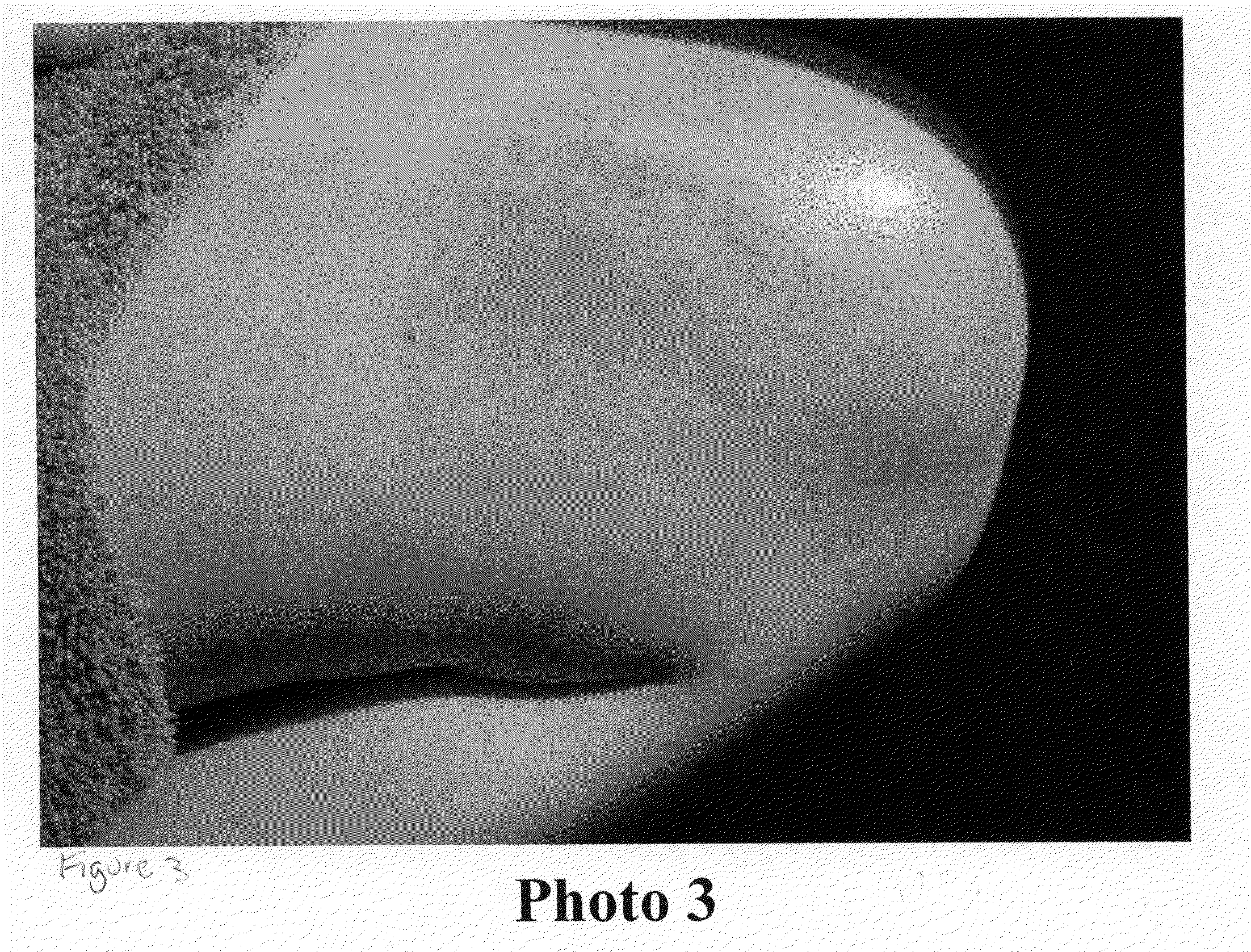 Treatments for burns using thyroid hormone compound in a human