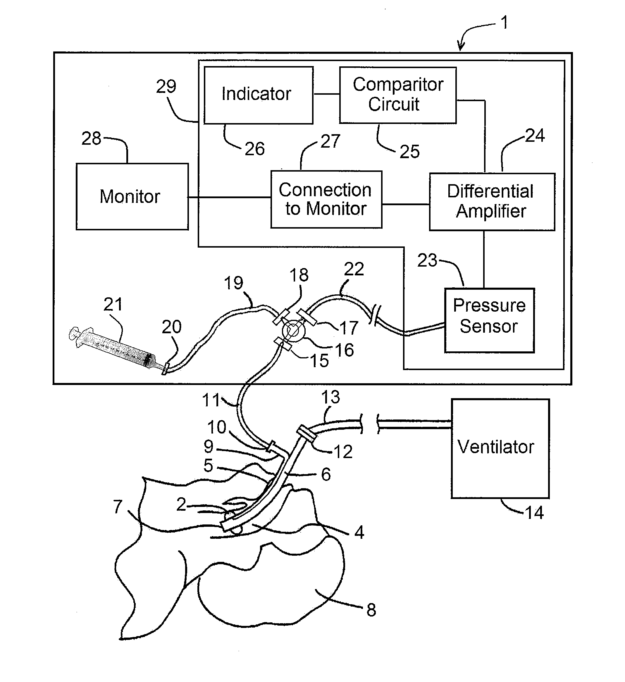 Endotracheal Tube Cuff Pressure Measuring Device