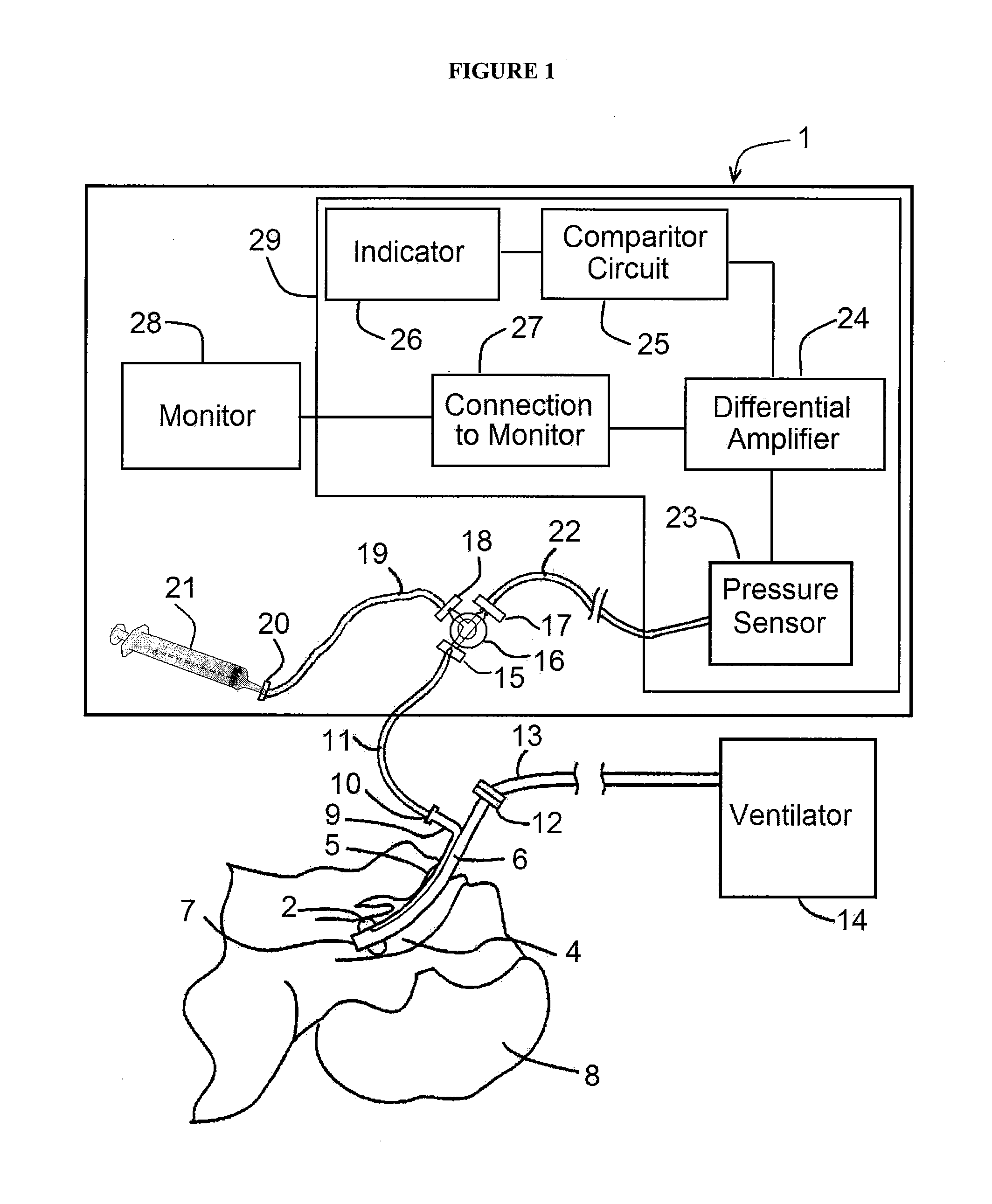 Endotracheal Tube Cuff Pressure Measuring Device