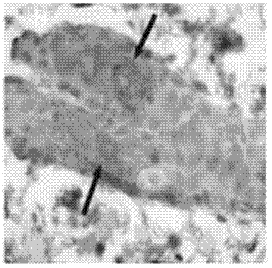 Protein with similar function of irisin structural domain, and composition comprising protein and application of protein