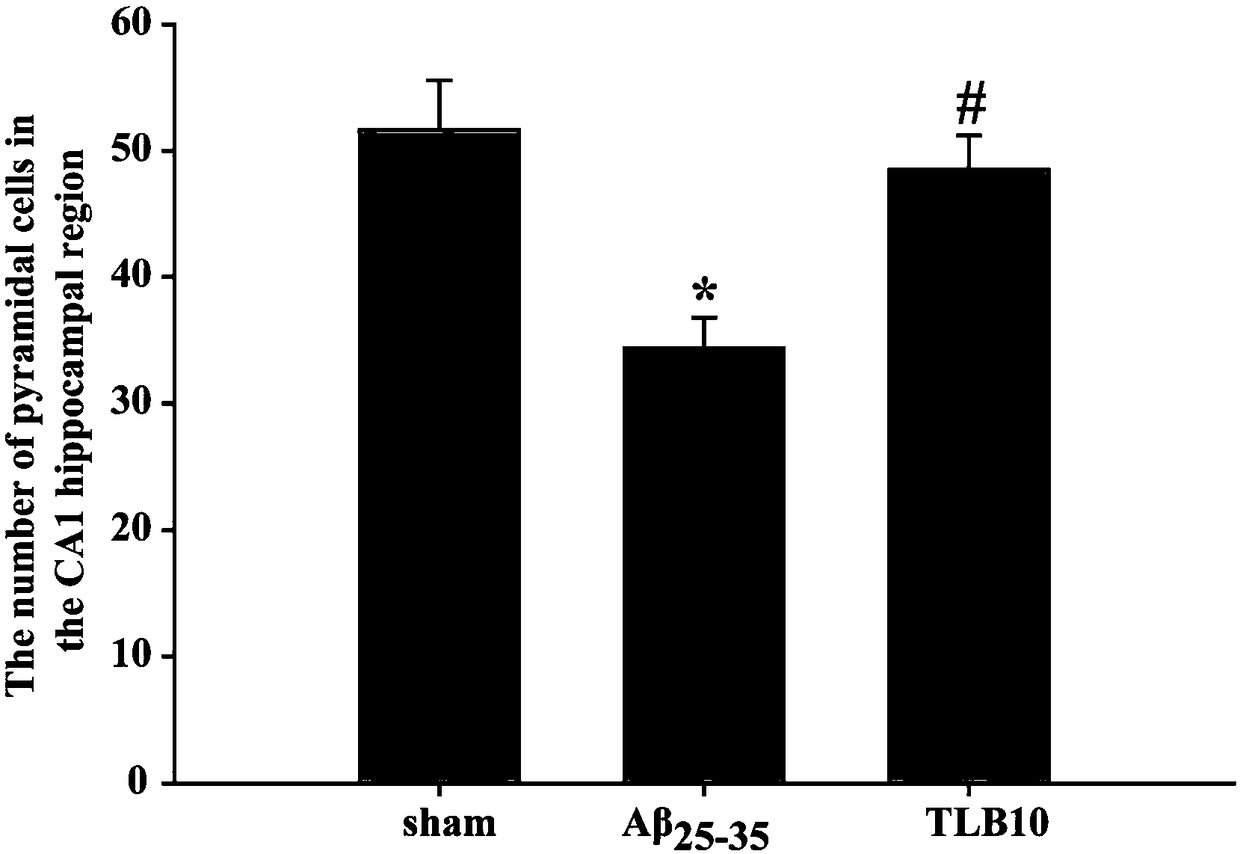 Application of trilobatin in preparing medicine for treating alzheimer disease