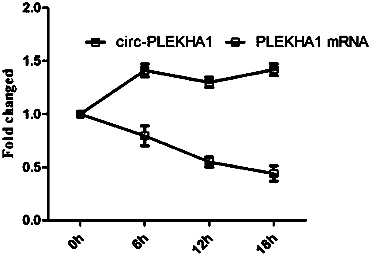 Application of circ-PLEKHA1 molecular marker in blood to diagnosis of ESCC (esophageal squamous carcinoma)